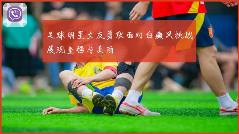 足球明星女友勇敢面对白癜风挑战展现坚强与美丽